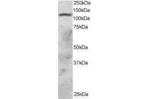 ABIN184814 staining (2µg/ml) of HepG2 lysate (RIPA buffer, 30µg total protein per lane). (RNF31 抗体  (C-Term))