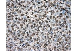 Immunohistochemical staining of paraffin-embedded colon tissue using anti-PTPRE mouse monoclonal antibody. (PTPRE 抗体)