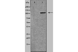 Western blot analysis of Jurkat  lysate using ITGA4 antibody. (ITGA4 抗体  (C-Term))