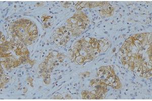 Immunohistochemistry (IHC) image for anti-Collagen, Type IV, alpha 2 (COL4A2) (N-Term) antibody (ABIN6258413)