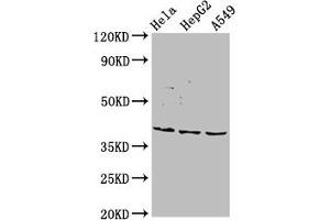 Western Blot Positive WB detected in: Hela whole cell lysate, HepG2 whole cell lysate, A549 whole cell lysate All lanes: NANS antibody at 5. (NANS 抗体  (AA 132-259))