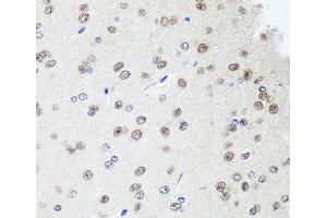 Immunohistochemistry of paraffin-embedded Rat brain using SAP18 Polyclonal Antibody at dilution of 1:100 (40x lens). (SAP18 抗体)