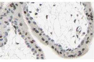 Image no. 2 for anti-SMAD, Mothers Against DPP Homolog 3 (SMAD3) (AA 417-425), (C-Term) antibody (ABIN401333) (SMAD3 抗体  (C-Term))