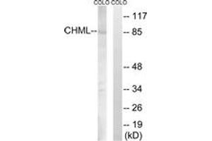 Western blot analysis of extracts from COLO cells, using CHML Antibody. (CHML 抗体  (AA 128-177))