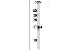 Western blot analysis in CEM cell line lysates (35ug/lane). (FAM163A 抗体  (AA 32-61))