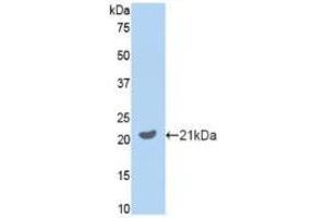 Western blot analysis of recombinant Mouse GAS6.