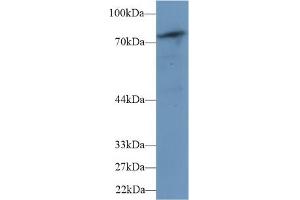 Detection of PLCd4 in Mouse Skeletal muscle lysate using Polyclonal Antibody to Phospholipase C Delta 4 (PLCd4) (PLCD4 抗体  (AA 1-250))