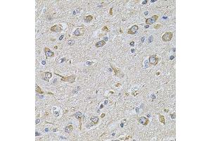 Immunohistochemistry of paraffin-embedded rat brain using FASTKD1 Antibody. (FASTKD1 抗体  (AA 638-847))