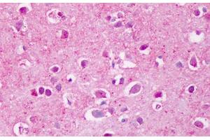 PTPRA 抗体  (Extracellular Domain)