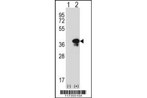 Western blot analysis of STX3 using rabbit polyclonal STX3 Antibody using 293 cell lysates (2 ug/lane) either nontransfected (Lane 1) or transiently transfected (Lane 2) with the STX3 gene.