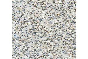 IHC analysis of UBE3A using anti-UBE3A antibody (ABIN7599562).