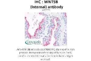 Image no. 1 for anti-Wingless-Type MMTV Integration Site Family, Member 5B (WNT5B) (Internal Region) antibody (ABIN1740831)