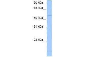 Western Blot showing RBM45 antibody used at a concentration of 1-2 ug/ml to detect its target protein. (RBM45 抗体  (Middle Region))