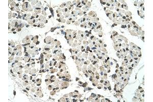 PSD3 antibody was used for immunohistochemistry at a concentration of 4-8 ug/ml to stain Skeletal muscle cells (arrows) in Human Muscle. (PSD3 抗体  (Middle Region))