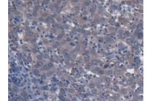 Immunohistochemistry (IHC) image for anti-Colony Stimulating Factor 2 Receptor, Beta (CSF2RB) (AA 133-233) antibody (ABIN7438586)