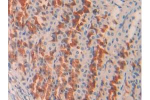 DAB staining on IHC-P; Samples: Rat Stomach Tissue (COL2A1 抗体  (AA 1226-1331))