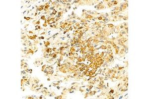 Immunohistochemistry (Paraffin-embedded Sections) (IHC (p)) image for anti-Protein Tyrosine Phosphatase G1 (PTPN12) antibody (ABIN7075292)
