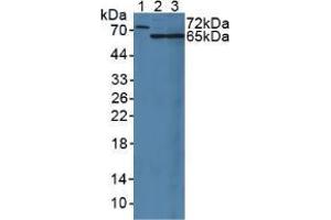 Western blot analysis of (1) Rat Serum, (2) Rat Liver Tissue and (3) Rat Kidney Tissue. (MUC20 抗体  (AA 113-347))