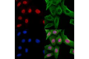 ABIN7094276 and ABIN7098323 staining Hela cells by IF/ICC. (Histone Cluster 1, H1t (HIST1H1T) (Internal Region) 抗体)