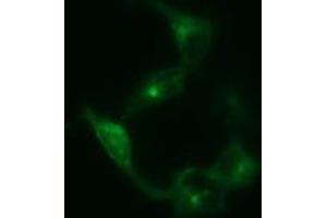 Image no. 1 for anti-Synaptophysin (SYP) antibody (ABIN1501255) (Synaptophysin 抗体)