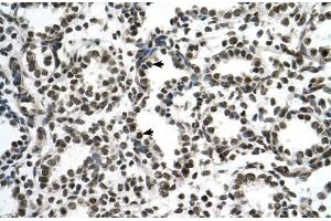 Human Lung; ZNF706 antibody - N-terminal region in Human Lung cells using Immunohistochemistry (ZNF706 抗体  (N-Term))