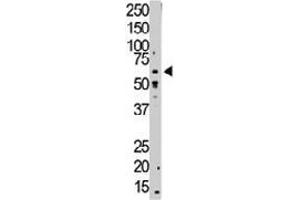 The TGFBR1 polyclonal antibody  is used in Western blot to detect TGFBR1 in mouse small intestine tissue lysate.