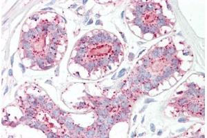 Image no. 2 for anti-Melanoma Antigen Family A, 1 (Directs Expression of Antigen MZ2-E) (MAGEA1) (AA 38-87) antibody (ABIN6749734) (MAGEA1 抗体  (AA 38-87))