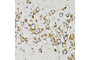 Immunohistochemistry (Paraffin-embedded Sections) (IHC (p)) image for anti-Ribophorin 1 (RPN1) (AA 20-280) antibody (ABIN6147170)