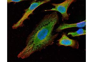 Indirect immunostaining of HELA cells with anti-syntaxin 18 (dilution 1 : 100; green) and anti-α-tubulin (, dilution 1 : 100; red). (Syntaxin 18 抗体  (AA 55-313))