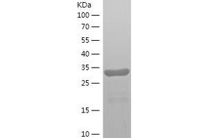 SEMG1 Protein (AA 25-235) (His tag)
