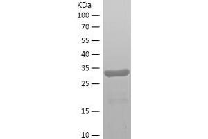 Western Blotting (WB) image for Semenogelin I (SEMG1) (AA 25-235) protein (His tag) (ABIN7282677) (SEMG1 Protein (AA 25-235) (His tag))