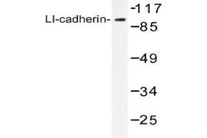 Western blot (WB) analysis of LI-cadherin antibody in extracts from Jurkat cells. (LI Cadherin 抗体)