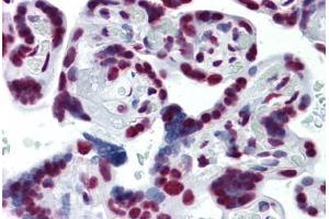 Human Placenta: Formalin-Fixed, Paraffin-Embedded (FFPE) (CDKL1 抗体  (AA 259-358))