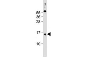 Western blot testing of human PC-3 cell lysate with SYNJBP antibody at 1:2000. (SYNJ2BP 抗体  (AA 22-66))