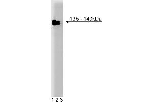 Western Blotting (WB) image for anti-General Transcription Factor III (GTF2I) (AA 17-123) antibody (ABIN968264) (GTF2I 抗体  (AA 17-123))