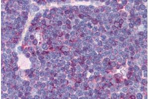 Human Thymus (formalin-fixed, paraffin-embedded) stained with CD99 antibody ABIN239808 at 10 ug/ml followed by biotinylated anti-mouse IgG secondary antibody ABIN481714, alkaline phosphatase-streptavidin and chromogen. (CD99 抗体)