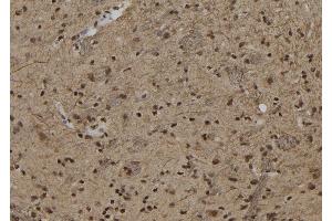 ABIN6279861 at 1/100 staining Rat brain tissue by IHC-P. (ZNF280B 抗体  (C-Term))