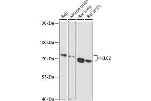 Western blot analysis of extracts of various cell lines, using KLC2 antibody (ABIN7268140) at 1:1000 dilution. (KLC2 抗体  (AA 1-90))