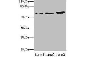 Western blot All lanes: ERVFRD-1 antibody at 3. (HERV-FRD Provirus Ancestral Env Polyprotein (Herv-frd) (AA 16-250) 抗体)