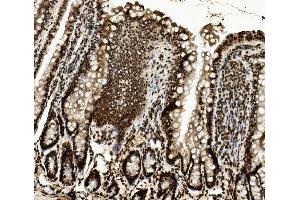 IHC analysis of DDX5 using anti-DDX5 antibody (ABIN7602561). (DDX5 抗体  (AA 85-328))