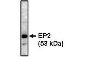 Western Blotting (WB) image for anti-Prostaglandin E Receptor 2 (Subtype EP2), 53kDa (PTGER2) antibody (ABIN264447) (PTGER2 抗体)