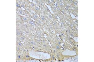 Immunohistochemistry of paraffin-embedded human liver using RPH3AL antibody at dilution of 1:100 (40x lens). (RPH3AL 抗体)