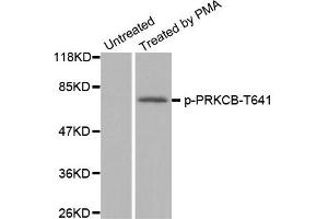Western Blotting (WB) image for anti-Protein Kinase C, beta (PRKCB) (pThr641) antibody (ABIN1870521) (PKC beta 抗体  (pThr641))