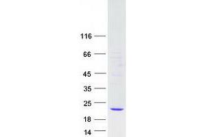 Western Blotting (WB) image for Glutathione Peroxidase 7 (GPX7) protein (Myc-DYKDDDDK Tag) (ABIN2722019)