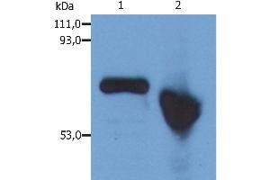 Western Blotting analysis of human alpha-Fetoprotein in Hep G2 human hepatocellular carcinoma cell line. (alpha Fetoprotein 抗体)
