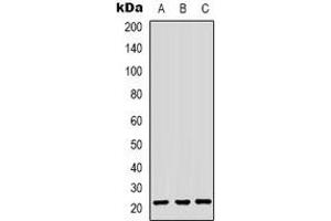 Western blot analysis of HP1 gamma expression in HepG2 (A), HEK293T (B), Hela (C) whole cell lysates. (CBX3 抗体)