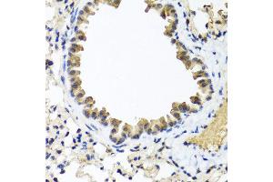 Immunohistochemistry of paraffin-embedded mouse lung using IFNL1 antibody at dilution of 1:100 (40x lens). (IL29 抗体)