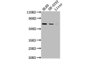 Western Blot Positive WB detected in: HL60 whole cell lysate, SH-SY5Y whole cell lysate, Mouse liver tissue All lanes: PTGS1 antibody at 1:2000 Secondary Goat polyclonal to rabbit IgG at 1/50000 dilution Predicted band size: 69, 65, 62, 57, 72, 73 kDa Observed band size: 72 kDa (Recombinant PTGS1 抗体)