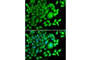 Immunofluorescence analysis of MCF-7 cells using CD47 antibody (ABIN5970938). (CD47 抗体)