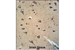 Immunohistochemistry (Paraffin-embedded Sections) (IHC (p)) image for anti-Aldehyde Dehydrogenase 2 Family (Mitochondrial) (ALDH2) antibody (ABIN658993)